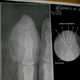 Illustration for article titled Guy Loses a Chunk of His Finger In Neodymium Magnet Accident (NSFW)